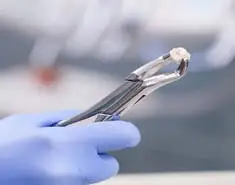 Tooth Extraction Dentist Philadelphia